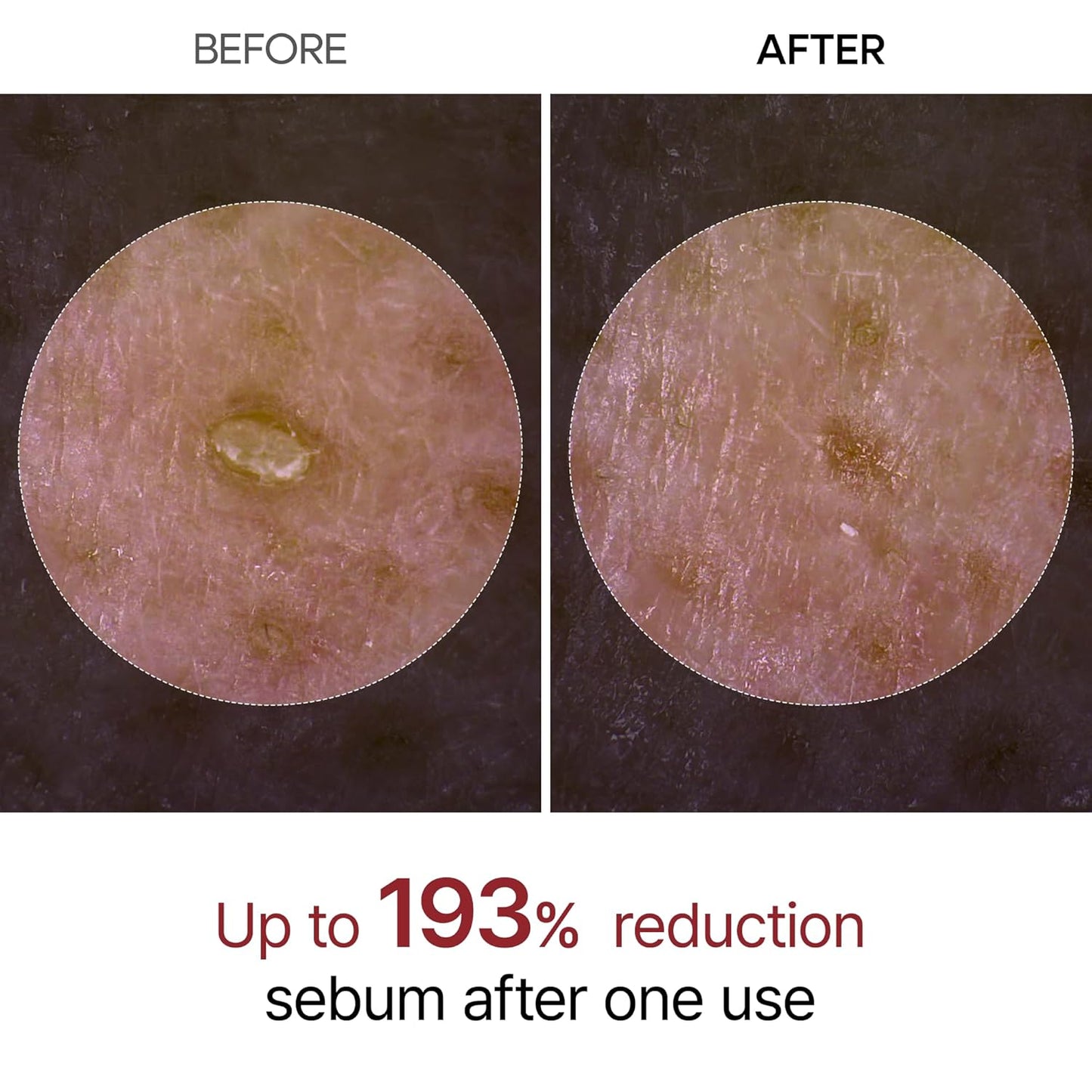 Radiant Glow Rice Peeling Ampoule™