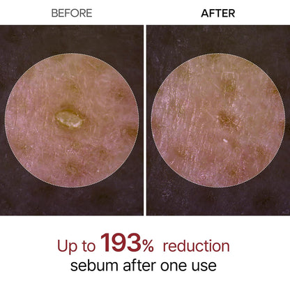 AURA™️- Ampoule de peeling au riz éclat radieux™
